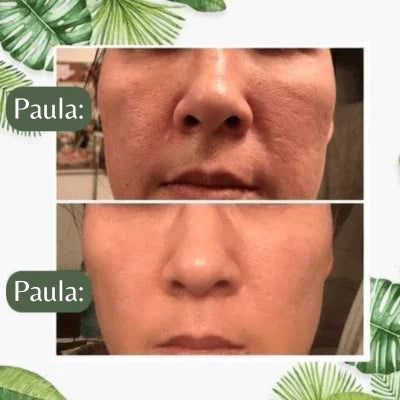 GreenMask® - Máscara de Limpeza Facial [+BRINDE ESPECIAL🎁]